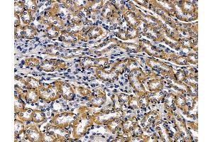 ABIN7096909 and ABIN7100975 at 1/100 staining mouse kidney tissue by IHC-P. (Clavesin 1 antibody)