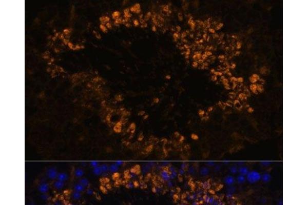 OXCT2 antibody