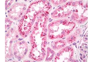 Immunohistochemistry (IHC) image for anti-Retinol Binding Protein 4, Plasma (RBP4) (AA 28-37) antibody (ABIN1103926)
