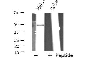 Western blot analysis of extracts from HeLa cells using ITPK1 antibody. (ITPK1 antibody  (Internal Region))