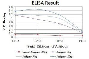 Red: Control Antigen (100 ng), Purple: Antigen (10 ng), Green: Antigen (50 ng), Blue: Antigen (100 ng), (MSX1 antibody)