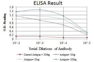 Red: Control Antigen (100 ng), Purple: Antigen (10 ng), Green: Antigen (50 ng), Blue: Antigen (100 ng), (MSX1 antibody)