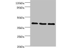Western blot All lanes: GPRC5A antibody at 8 μg/mL Lane 1: Hela whole cell lysate Lane 2: HepG2 whole cell lysate Lane 3: MCF-7 whole cell lysate Secondary Goat polyclonal to rabbit IgG at 1/10000 dilution Predicted band size: 40 kDa Observed band size: 40 kDa (GPRC5A antibody  (AA 258-357))