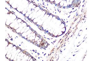 Immunohistochemistry of paraffin-embedded human colon using FHL1 Rabbit mAb (ABIN1680536, ABIN3019332, ABIN3019333 and ABIN7101753) at dilution of 1:100 (40x lens).