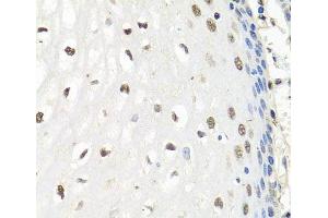 Immunohistochemistry of paraffin-embedded Human esophagus using CNOT8 Polyclonal Antibody at dilution of 1:100 (40x lens). (CNOT8 antibody)
