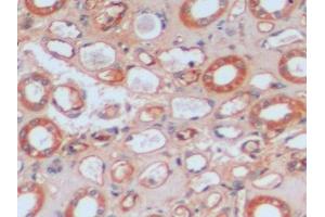 Detection of ICAM1 in Human Kidney Tissue using Polyclonal Antibody to Intercellular Adhesion Molecule 1 (ICAM1) (ICAM1 antibody  (AA 41-464))