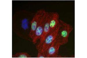 Immunofluorescence (IF) image for anti-DEAD (Asp-Glu-Ala-Asp) Box Polypeptide 5 (DDX5) antibody (ABIN2664927) (DDX5 antibody)