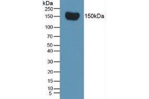 Mouse Capture antibody from the kit in WB with Positive Control: Rat Serum. (Complement Factor H ELISA Kit)