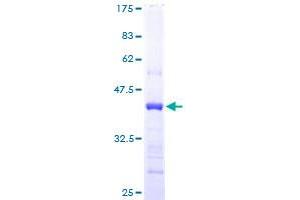 CST6 Protein (AA 29-149) (GST tag)