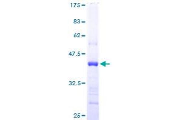CST6 Protein (AA 29-149) (GST tag)