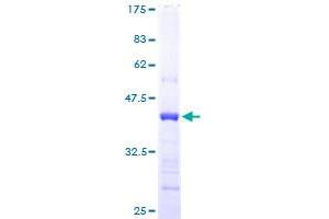 Image no. 1 for Cystatin E/M (CST6) (AA 29-149) protein (GST tag) (ABIN1350587) (CST6 Protein (AA 29-149) (GST tag))