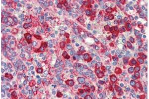 Human Spleen (formalin-fixed, paraffin-embedded) stained with HSP90B1 antibody ABIN462106 at 10 ug/ml followed by biotinylated secondary antibody, alkaline phosphatase-streptavidin and chromogen. (GRP94 antibody)