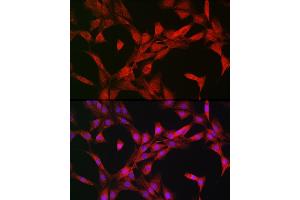 Immunofluorescence (IF) image for anti-Ribosomal Protein S6 Kinase, 70kDa, Polypeptide 1 (RPS6KB1) (AA 1-352) antibody (ABIN3023169)