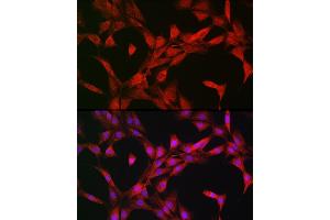 Immunofluorescence analysis of NIH-3T3 cells using p70 S6 Kinase 1 1 Rabbit pAb (ABIN3023168, ABIN3023169, ABIN3023170, ABIN1513490 and ABIN6219422) at dilution of 1:100 (40x lens). (RPS6KB1 antibody  (AA 1-352))