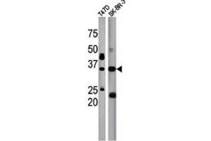 Western Blotting (WB) image for anti-Isoprenylcysteine Carboxyl Methyltransferase (ICMT) antibody (ABIN3001554) (ICMT antibody)