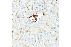 Immunohistochemistry of paraffin-embedded mouse liver using alpha 1 Spectrin antibody (ABIN6129333, ABIN6148401, ABIN6148402 and ABIN6215956) at dilution of 1:100 (40x lens). (SPTA1 antibody  (AA 940-1160))