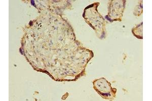 Immunohistochemistry of paraffin-embedded human placenta tissue using ABIN7172361 at dilution of 1:100 (TRAPPC3 antibody  (AA 1-180))