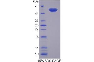 Image no. 1 for Annexin A11 (ANXA11) (AA 1-505) protein (His tag) (ABIN6237066)