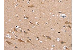 The image on the left is immunohistochemistry of paraffin-embedded Human brain tissue using ABIN7130278(MSMB Antibody) at dilution 1/30, on the right is treated with fusion protein. (MSMB antibody)