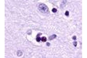 Anti-EDG2 antibody IHC of human brain, neuron and glia. (LPAR1 antibody  (Cytoplasmic Domain))