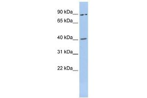 MEIS3 antibody used at 0. (MEIS3 antibody  (Middle Region))
