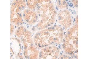 Figure. (AASDHPPT antibody  (AA 1-309))