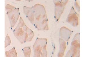 Detection of IL18 in Rat Skeletal muscle Tissue using Polyclonal Antibody to Interleukin 18 (IL18) (IL-18 antibody  (AA 37-194))