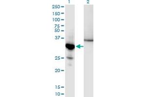Western Blotting (WB) image for anti-Nuclear Factor of kappa Light Polypeptide Gene Enhancer in B-Cells Inhibitor, alpha (NFKBIA) (AA 1-317) antibody (ABIN1326940)
