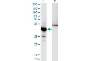 Western Blot analysis of NFKBIA expression in transfected 293T cell line by NFKBIA monoclonal antibody (M10), clone 3H4.