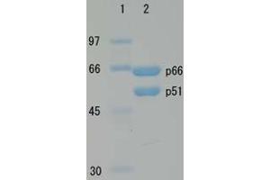 SDS-PAGE (SDS) image for HIV-1 Reverse Transcriptase (HIV1RT) (Active) protein (ABIN2452197)