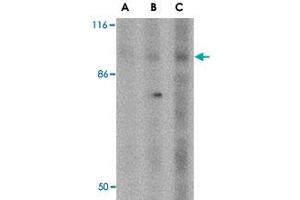 Western blot analysis of DISC1 in SK-N-SH cell lysate with DISC1 polyclonal antibody  at (A) 0. (DISC1 antibody  (Internal Region))