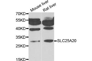 Western blot analysis of extracts of various cell lines, using SLC25A20 antibody (ABIN5974144) at 1/1000 dilution. (SLC25A20 antibody)