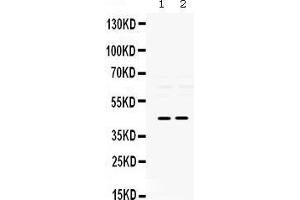 Observed bind size: 45KD (PAX2A antibody  (C-Term))