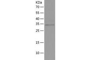 Western Blotting (WB) image for Serine Dehydratase-Like (SDSL) (AA 1-329) protein (His tag) (ABIN7288359) (SDSL Protein (AA 1-329) (His tag))