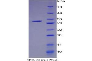 SDS-PAGE analysis of Human MEPE Protein.