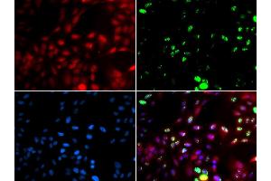 Immunofluorescence analysis of GFP-RNF168 transgenic U2OS cells using POLK antibody (ABIN5973607). (POLK antibody)
