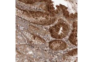 Immunohistochemical staining (Formalin-fixed paraffin-embedded sections) of human stomach with PEAK1 polyclonal antibody  shows distinct cytoplasmic and membrane positivity in glandular cells.