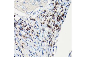 Immunohistochemistry (IHC) image for anti-CD247 Molecule (CD247) (AA 50-164) antibody (ABIN3022813)