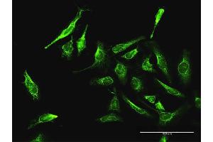 Immunofluorescence of purified MaxPab antibody to DAXX on HeLa cell. (DAXX antibody  (AA 1-740))