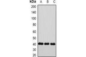 Western blot analysis of Connexin 40 expression in HepG2 (A), mouse heart (B), rat heart (C) whole cell lysates. (Cx40/GJA5 antibody)