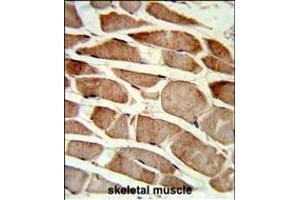 Formalin-fixed and paraffin-embedded human skeletal muscle reacted with TAGLN Antibody (C-term), which was peroxidase-conjugated to the secondary antibody, followed by DAB staining. (Transgelin antibody  (C-Term))