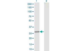 Western Blot analysis of CLTA expression in transfected 293T cell line by CLTA monoclonal antibody (M12), clone 4D5. (CLTA antibody  (AA 1-218))