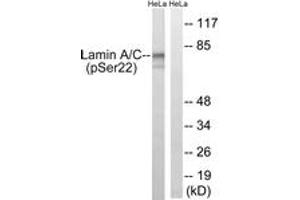 Western blot analysis of extracts from HeLa cells treated with paclitaxel 1uM 24h, using Lamin A (Phospho-Ser22) Antibody. (Lamin A/C antibody  (pSer22))