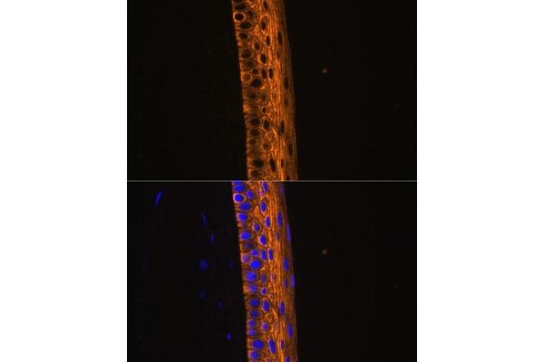 MYH13 antibody  (AA 1240-1320)