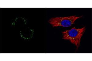 ICC/IF Image c-Met antibody [c3], c-term detects c-Met protein at cytoplasm by immunofluorescent analysis. (c-MET antibody  (C-Term))