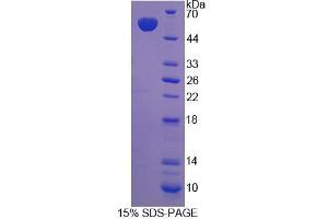 SDS-PAGE analysis of Rat ABCC11 Protein. (ABCC11 Protein)