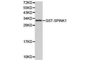 Western Blotting (WB) image for anti-serine Peptidase Inhibitor, Kazal Type 1 (SPINK1) antibody (ABIN1874923)