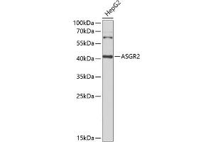 Western blot analysis of extracts of HepG2 cells, using  Antibody (ABIN6127456, ABIN6137183, ABIN6137186 and ABIN6221878) at 1:1000 dilution. (Asialoglycoprotein Receptor 2 antibody  (AA 58-287))