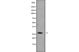 Western blot analysis of SLC25A27 expression in 293T cell lysate,The lane on the left is treated with the antigen-specific peptide. (SLC25A27 antibody  (C-Term))