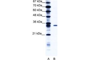 Western Blotting (WB) image for anti-Kv Channel Interacting Protein 4 (KCNIP4) antibody (ABIN2461007) (KCNIP4 antibody)